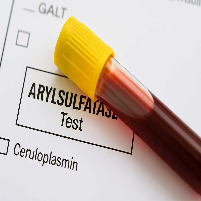 -Arylsulfatase-A.jpg