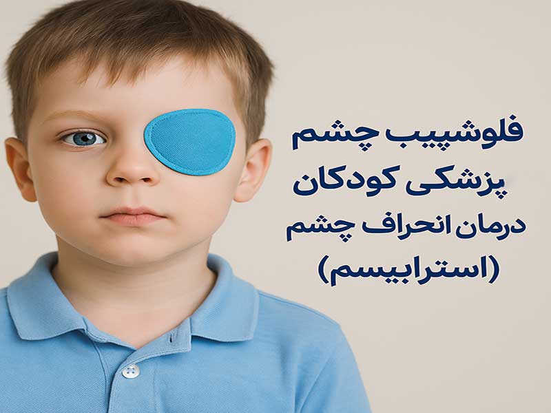 -چشم-کودکان.jpg
